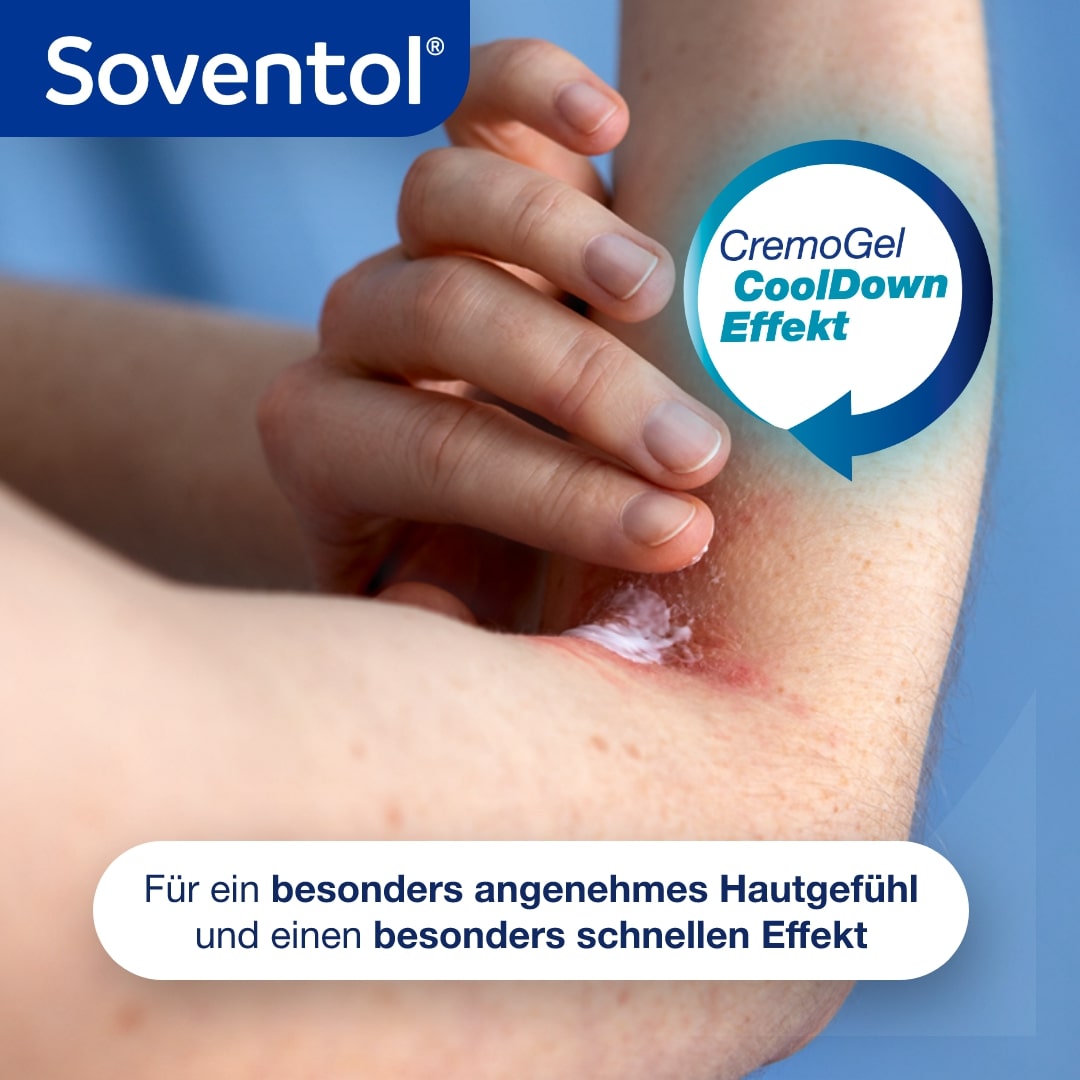 Soventol Hydrocortisonacetat 0,5% bei Hautentzündungen, Hautallergie sowie Sonnenbrand 15g